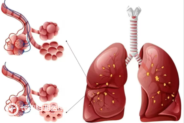 1753861302546140.png image.png