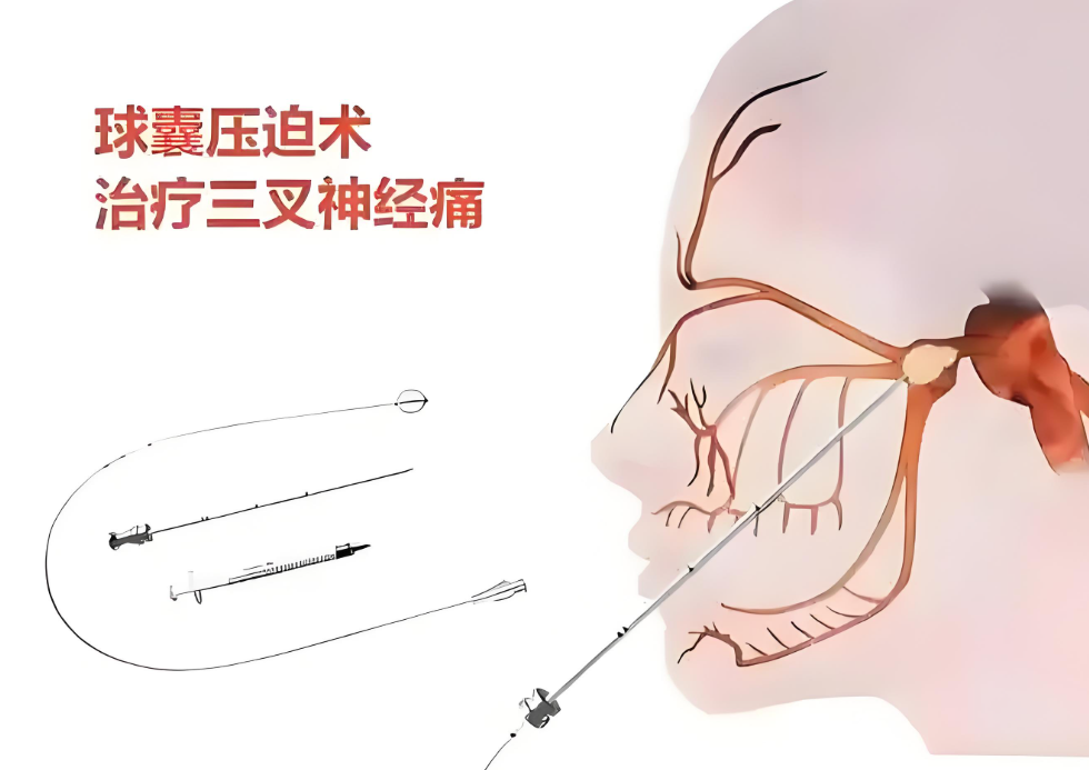 1754962426129345.png image.png