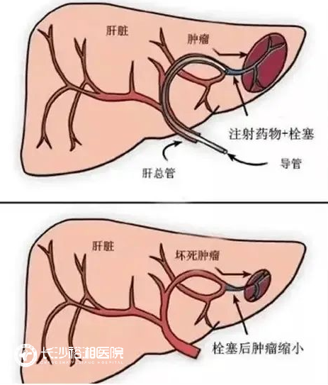 1755762085517148.png image.png