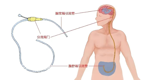 1756274978110406.png image.png